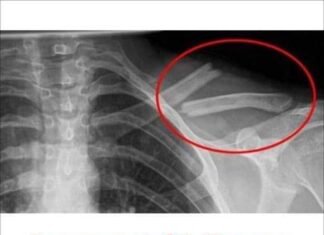 Ce se petrece în organismul tău când consumi băuturi carbogazoase: un obicei care poate afecta sănătatea ta.