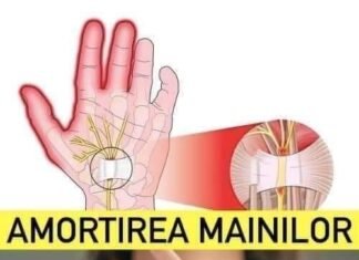 Amorțirea Mâinilor: Află de ce îți amorțesc în somn – Este un semnal de alarmă!