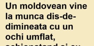 Bancul zilei: Un moldovean ajunge la muncă șchiopătând, cu mâna în ghips!