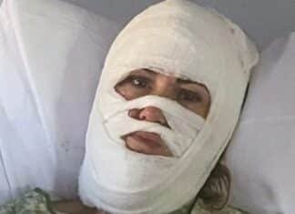 Femeie de 46 de ani atacată cu acid într-un parc; Poliția și FBI-ul îl caută pe agresor.